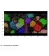 Tree counting software